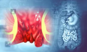 Selles rouges après betteraves : combien de temps cela dure-t-il ?