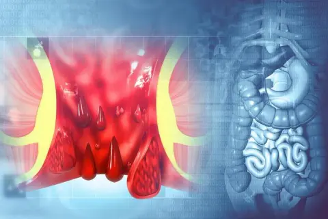 Selles rouges après betteraves : combien de temps cela dure-t-il ?